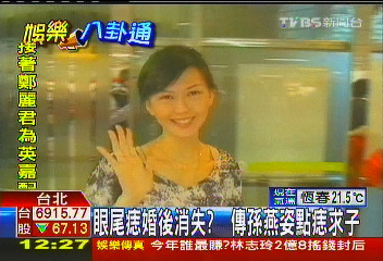 眼尾痣婚後消失? 傳孫燕姿點痣求子