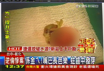 係金ㄟ!嘴巴長芭樂 蛀齒中發芽