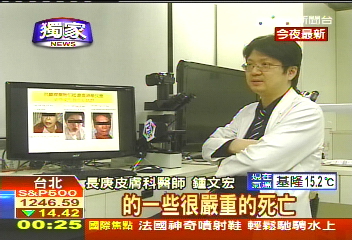 〈獨家〉癲癇藥恐引過敏! 台灣研究躍國際