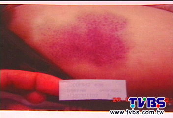 攤位怎擺爆口角 2菜販打趴婦還數秒