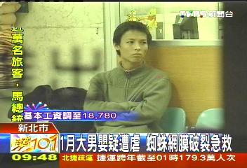 與女友爭吵鬆手 1月大男嬰頭重創