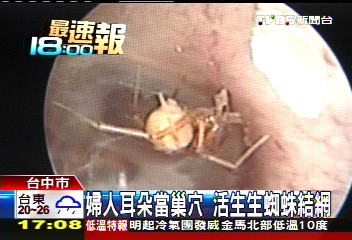 婦人耳朵當巢穴　活生生蜘蛛結網