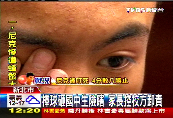 看嘸!練棒球遭砸險瞎 國中家長求償
