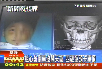 粗心爸倒車沒關天窗 4歲童頭卡車頂