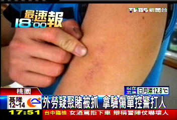 外勞疑聚賭被抓 拿驗傷單控警打人