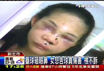 壘球砸眼鼻！女怒告球員傷害　檢不訴