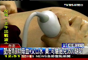 母血+父口水　美：可驗胎兒3500缺陷