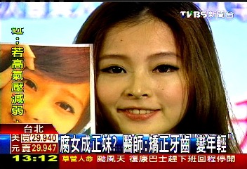 腐女成正妹? 醫師:矯正牙齒「變年輕」