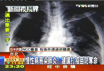 慢性病易染肺炎！　建議打疫苗防奪命
