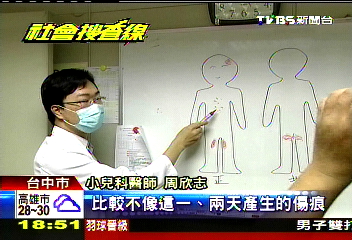 11月嬰嗆水昏迷 全身新舊傷疑遭虐