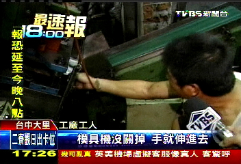 伸手清除鐵屑 工人手掌壓斷搶救