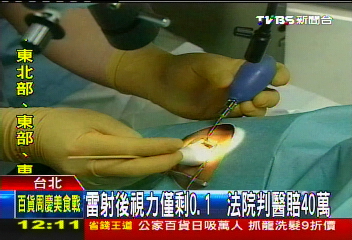 雷射後視力僅剩0.1 法院判醫賠40萬