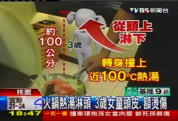 火鍋熱湯淋頭 3歲女童頭皮、額燙傷