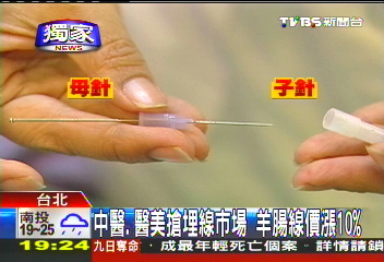 〈獨家〉中醫、醫美搶埋線市場 羊腸線價漲10%