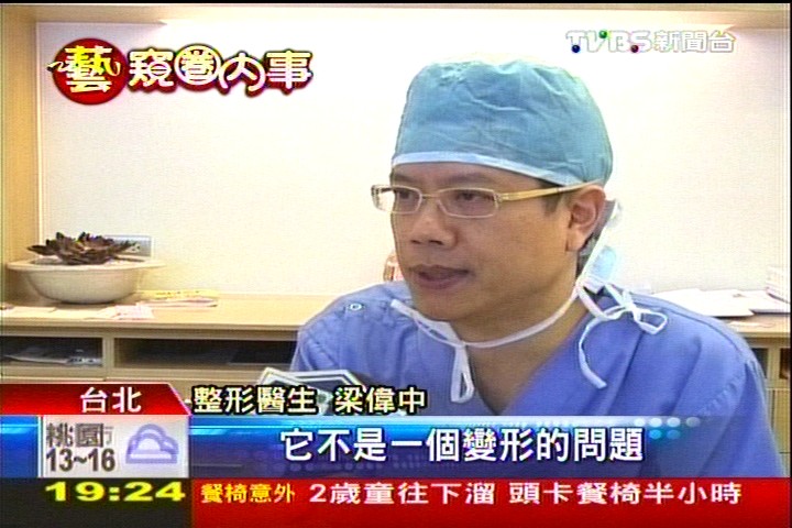 塌鼻變挺遭疑整形　孫儷：用夾子夾的