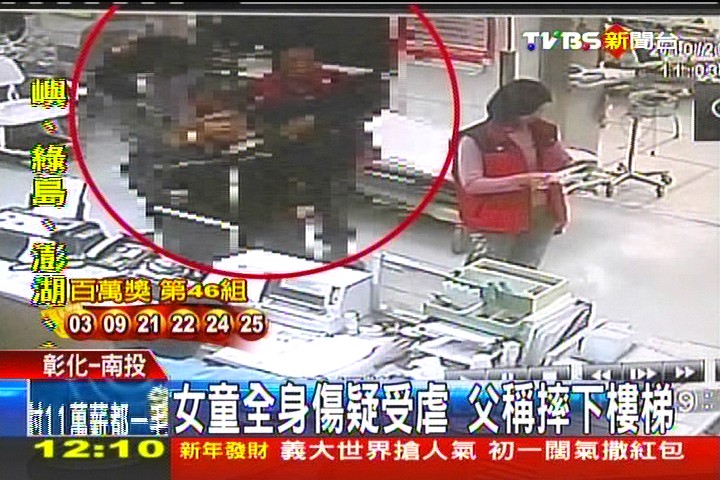 女童全身傷疑受虐 父稱摔下樓梯