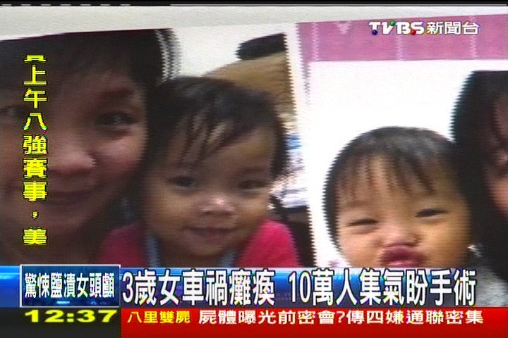 3歲女車禍癱瘓 10萬人集氣盼手術