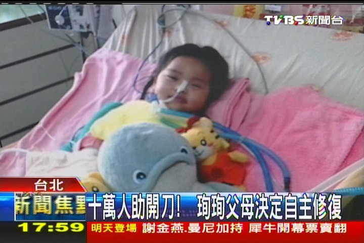手腳有反應+呼吸進步 珣珣暫不開刀