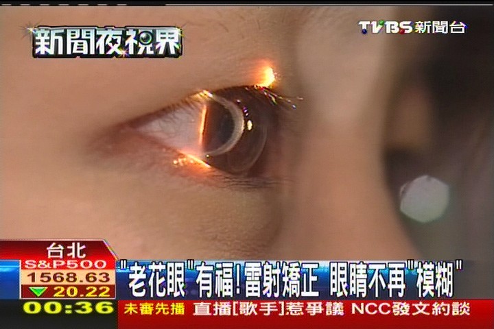 「老花眼」有福！雷射矯正　眼睛不再「模糊」