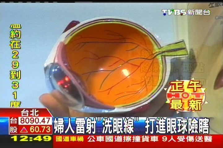 婦人雷射「洗眼線」　打進眼球險瞎