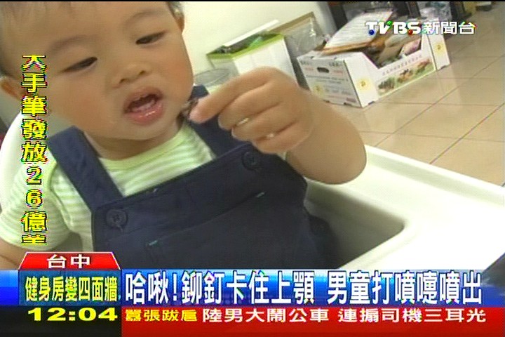 哈啾!鉚釘卡住上顎 男童打噴嚏噴出
