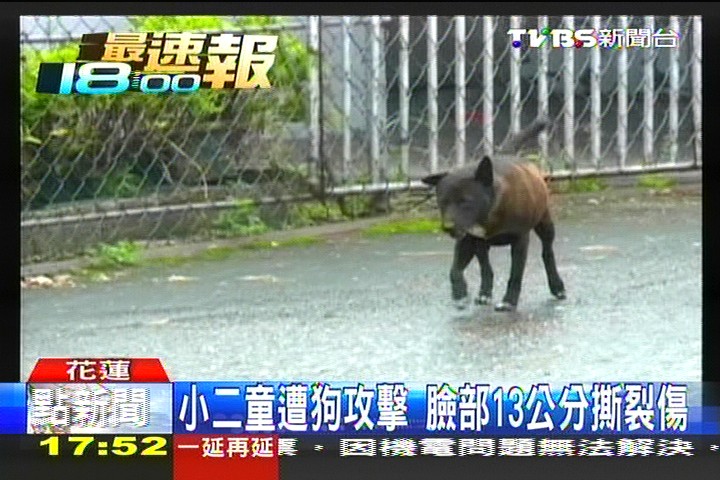 小二童遭狗攻擊　臉部13公分撕裂傷