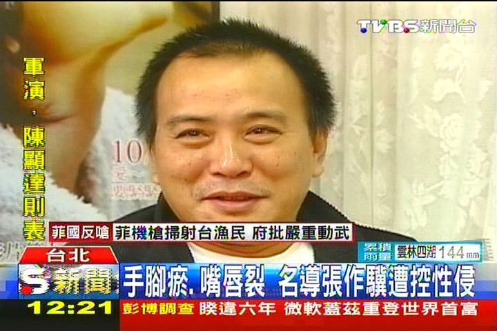 手腳瘀、嘴唇裂 名導張作驥遭控性侵