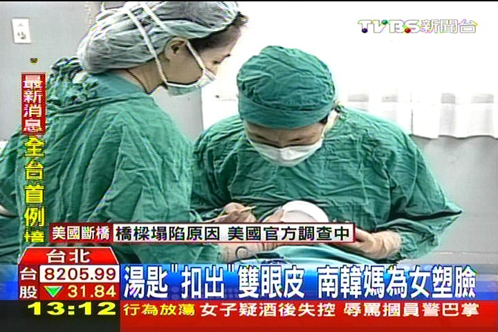 湯匙「扣出」雙眼皮　南韓媽為女塑臉