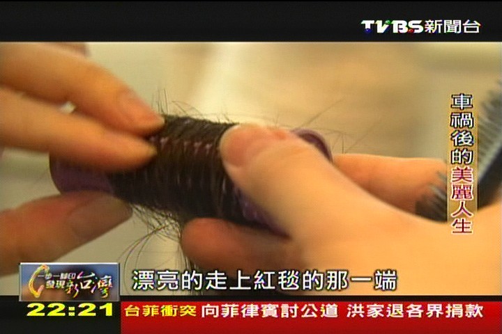 【一步一腳印】車禍後的美麗人生