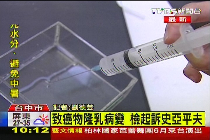 〈快訊〉致癌物隆乳病變 檢起訴史亞平夫