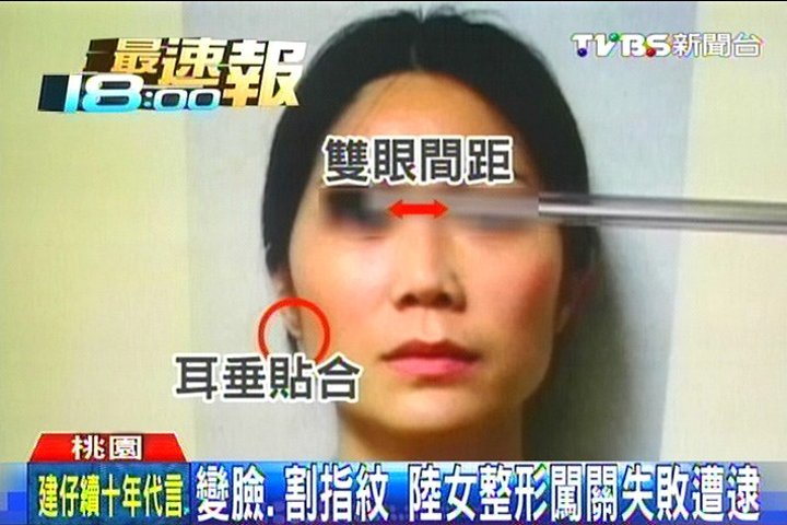 變臉、割指紋 陸女整形闖關失敗遭逮