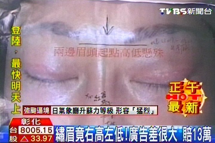 繡眉竟右高左低!廣告差很大 賠13萬