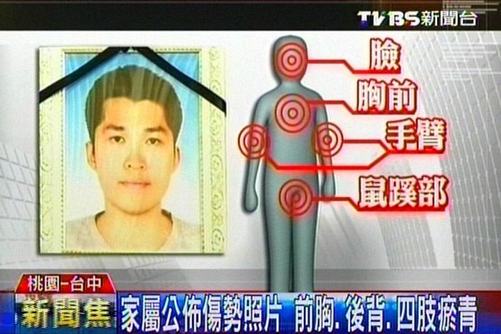 中暑？遭虐？洪仲丘傷勢照曝光　淤青多