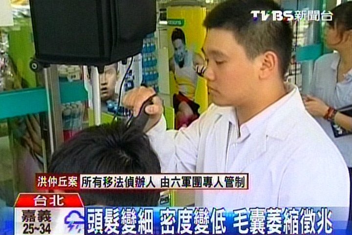 頭髮變細、密度變低　毛囊萎縮徵兆