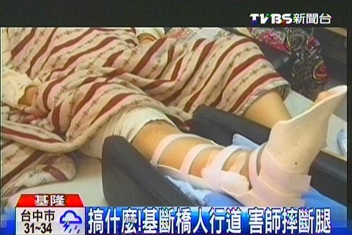 搞什麼！基斷橋人行道　害師摔斷腿