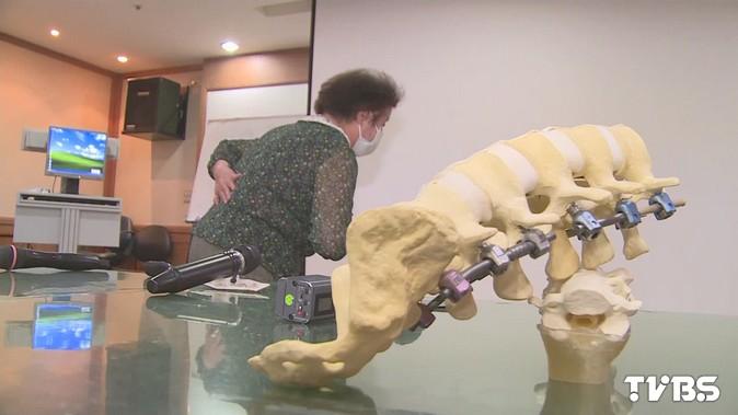 8旬婦咳一口痰　太用力…腰椎塌陷劇痛